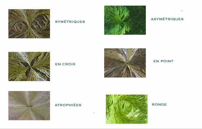 Planche : différentes formes de vacuoles